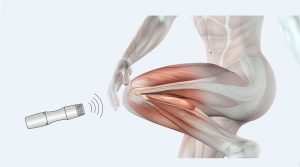 Blast Medwave Shockwave Therapy at Johari Digital