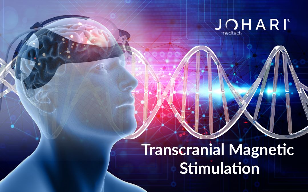 transcranial magnetic stimulation device manufacturer